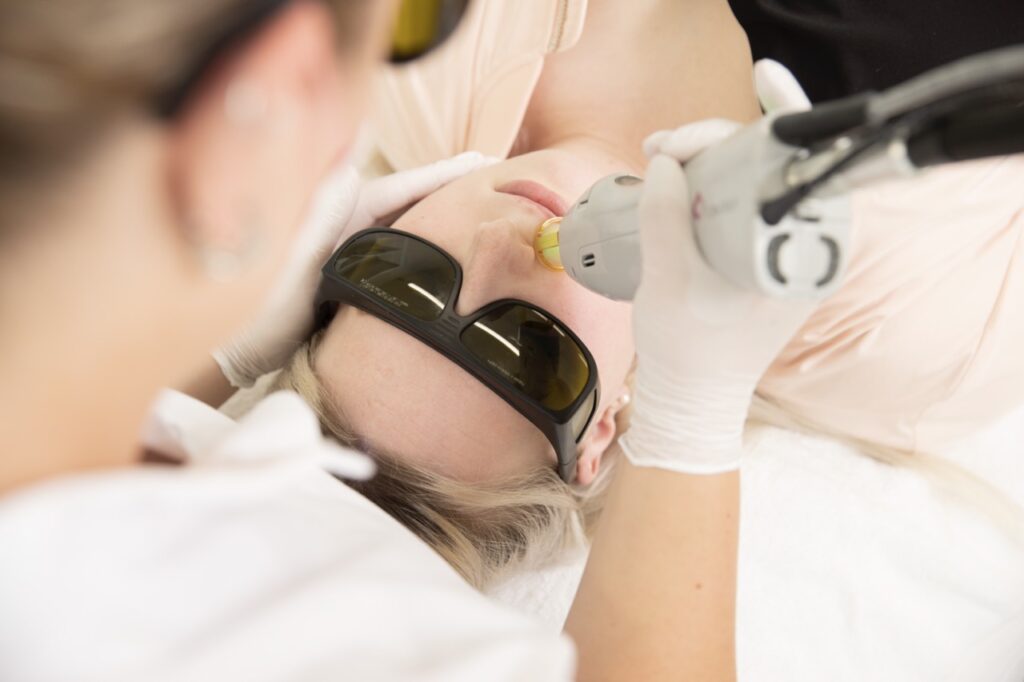 Bovenlip laseren Huidzorg Clinics