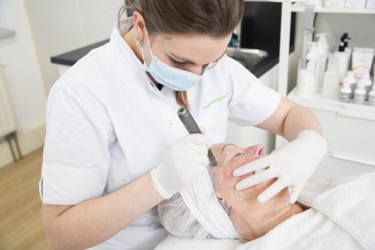 Skin Boost Behandeling Dermapen